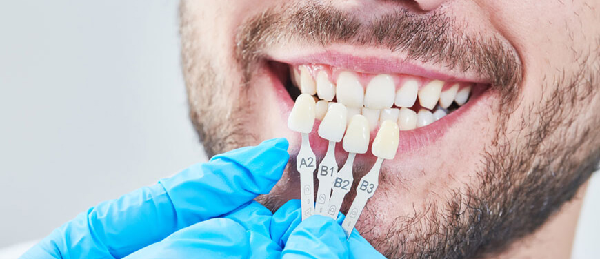 Smart Smile Design